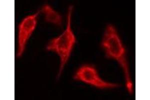 ABIN6275435 staining 293 cells by IF/ICC. (RAB3GAP1 抗体  (Internal Region))
