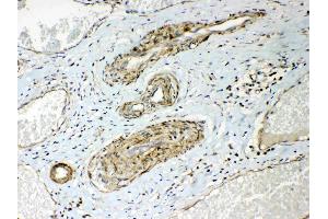 Immunohistochemistry (IHC) image for anti-Heat Shock 22kDa Protein 8 (HSPB8) (AA 1-196) antibody (ABIN5518846)