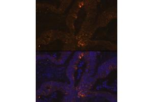 Immunofluorescence analysis of human colon carcinoma using TFF1/pS2 Rabbit mAb (ABIN7270972) at dilution of 1:100 (40x lens). (TFF1 抗体  (pSer2))