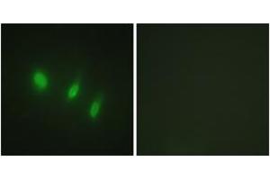 Immunofluorescence analysis of HeLa cells, using FOXO4 (Ab-451) Antibody.
