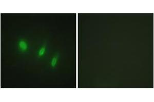 Immunofluorescence analysis of HeLa cells, using FOXO4 (Ab-451) Antibody.
