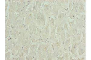 Immunohistochemistry of paraffin-embedded human heart tissue using ABIN7176171 at dilution of 1:100 (ZNF226 抗体  (AA 1-94))