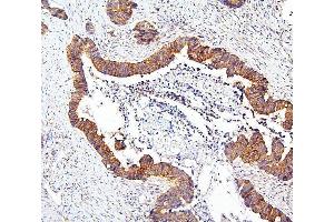 IHC analysis of MTOR using anti-MTOR antibody (ABIN6719566).