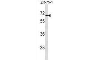UGT2B28 Antibody (Center) (ABIN1881976 and ABIN2838847) western blot analysis in ZR-75-1 cell line lysates (35 μg/lane).