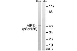 Western Blotting (WB) image for anti-Autoimmune Regulator (AIRE) (pSer156) antibody (ABIN1847730) (AIRE 抗体  (pSer156))