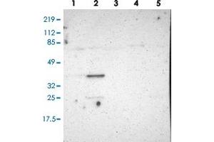 Western blot analysis of Lane 1: RT-4, Lane 2: U-251 MG, Lane 3: Human Plasma, Lane 4: Liver, Lane 5: Tonsil with PLSCR4 polyclonal antibody (PAB28547) at 1:100-1:250 dilution. (PLSCR4 抗体)