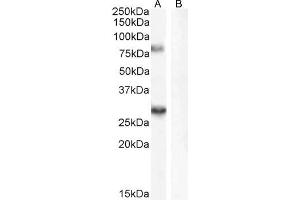 ABIN185715 (0. (SV2A 抗体  (Internal Region))