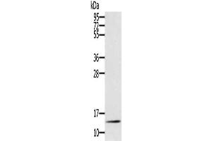Gel: 12 % SDS-PAGE, Lysate: 40 μg, Lane: Mouse liver tissue, Primary antibody: ABIN7130906(RNF7 Antibody) at dilution 1/250, Secondary antibody: Goat anti rabbit IgG at 1/8000 dilution, Exposure time: 10 minutes (RNF7 抗体)