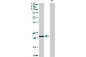 Western Blot analysis of FTH1 expression in transfected 293T cell line by FTH1 MaxPab polyclonal antibody. (FTH1 抗体  (AA 1-183))