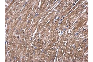 IHC-P Image USP4 antibody detects USP4 protein at cytoplasm in mouse muscle by immunohistochemical analysis. (USP4 抗体  (Center))