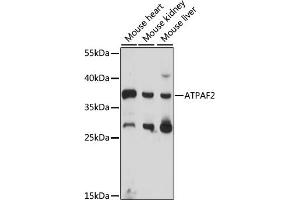 Western blot analysis of extracts of various cell lines, using  antibody (ABIN7265717) at 1000 dilution. (ATPAF2 抗体  (AA 41-200))