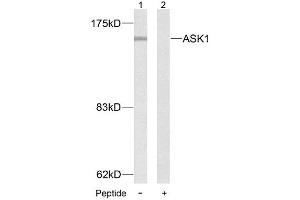 Western blot analysis of extract from MDA-MB- 435 cells, using ASK1 (Ab-83) antibody (E021125). (ASK1 抗体)