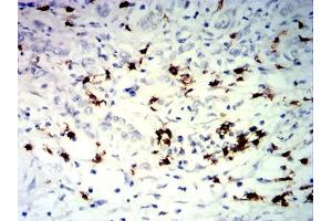 Immunohistochemistry (IHC) image for anti-Tumor Necrosis Factor Receptor Superfamily, Member 25 (TNFRSF25) antibody (ABIN7193676)