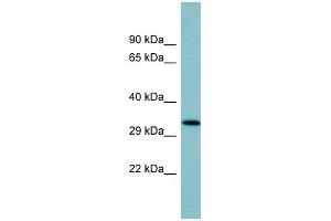 SFTPD antibody used at 1 ug/ml to detect target protein. (SFTPD 抗体  (Middle Region))