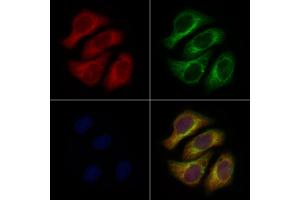 ABIN6260918 and ABIN6276952 staining Hela cells by IF/ICC.