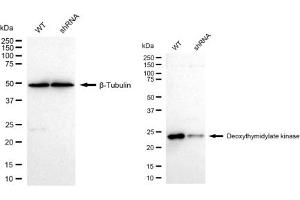 Western blotting analysis using Deoxythymidylate kinase antibody (ABIN7798311). (Recombinant DTYMK 抗体)