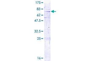 MRPL3 Protein (AA 1-348) (GST tag)