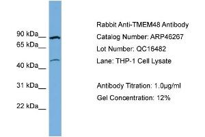 WB Suggested Anti-TMEM48  Antibody Titration: 0.