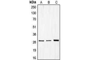 Western blot analysis of CDCA3 expression in MCF7 (A), Caco2 (B), HepG2 (C) whole cell lysates. (CDCA3 抗体  (C-Term))