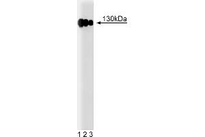 Western Blotting (WB) image for anti-Integrin beta 1 (ITGB1) (AA 76-256) antibody (ABIN967992) (ITGB1 抗体  (AA 76-256))