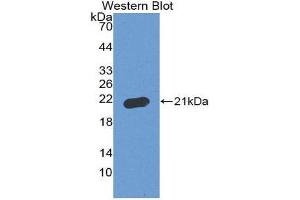 Western Blotting (WB) image for anti-Apoptosis-Associated tyrosine Kinase (AATK) (AA 1216-1374) antibody (ABIN2117008) (AATK 抗体  (AA 1216-1374))