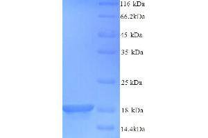 SDS-PAGE (SDS) image for Baculoviral IAP Repeat-Containing 5 (BIRC5) (AA 1-140), (full length) protein (His tag) (ABIN5713282) (Survivin Protein (AA 1-140, full length) (His tag))