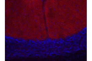 Indirect immunostaining of PFA fixed mouse cerebellum section (dilution 1 : 200; red). (CACNA1B 抗体)
