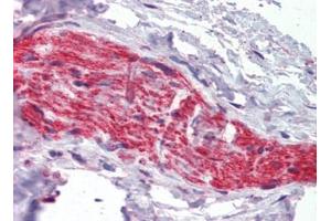 Nerve, Human: Formalin-Fixed, Paraffin-Embedded (FFPE) (Ankyrin G 抗体)