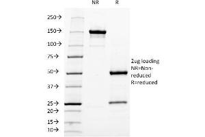 SDS-PAGE (SDS) image for anti-Neurofilament, Heavy Polypeptide (NEFH) antibody (ABIN6940180)