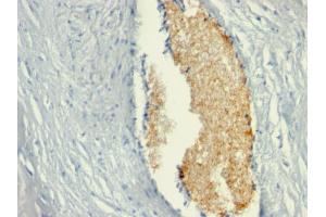 Formalin-fixed, paraffin-embedded human Placenta stained with AMPD3 Mouse Monoclonal Antibody (AMPD3/901) (AMPD3 抗体)
