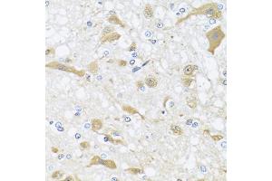 Immunohistochemistry of paraffin-embedded rat brain using APOL1 antibody (ABIN5975231) at dilution of 1/100 (40x lens). (APOL1 抗体)
