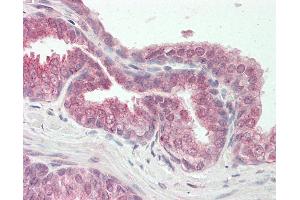 Human Prostate: Formalin-Fixed, Paraffin-Embedded (FFPE).
