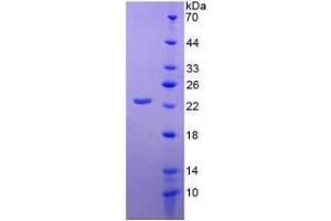 Image no. 1 for CD276 (CD276) (AA 47-219) (Active) protein (His tag) (ABIN6239908)