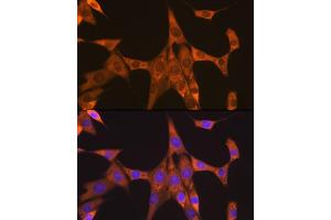 Immunofluorescence analysis of NIH-3T3 cells using FXR1 Rabbit mAb (ABIN7267257) at dilution of 1:100 (40x lens). (FXR1 抗体)