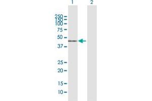 Western Blot analysis of ACADM expression in transfected 293T cell line by ACADM MaxPab polyclonal antibody. (Medium-Chain Specific Acyl-CoA Dehydrogenase, Mitochondrial (MCAD) (AA 1-421) 抗体)