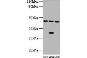 Western blot All lanes: HPD antibody at 4. (HPD 抗体  (AA 2-393))