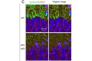 Representative images demonstrating vGlut1 (red) and Synapsin (green) immunofluorescence staining in CA1, DG, CA3, and CTX of the mouse brain.