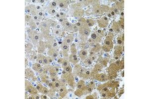 Immunohistochemistry of paraffin-embedded human liver damage using RNF166 antibody (ABIN6135036, ABIN6147021, ABIN6147024 and ABIN6224290) (40x lens). (RNF166 抗体  (C-Term))