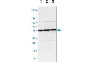 Western blot analysis of Lane 1: NIH-3T3 cell lysate (Mouse embryonic fibroblast cells), Lane 2: NBT-II cell lysate (Rat Wistar bladder tumour cells), Lane 3: PC12 cell lysate (Pheochromocytoma of rat adrenal medulla) with DLST polyclonal antibody .