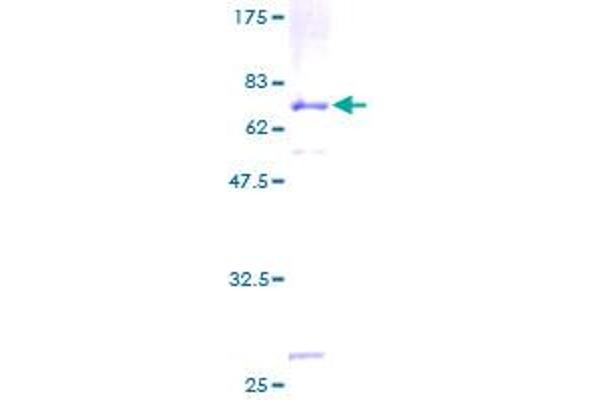 Cathepsin D Protein (CTSD) (AA 26-412) (GST tag)