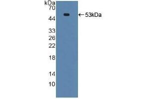 Detection of Recombinant TNFRSF10B, Human using Polyclonal Antibody to Death receptor 5 (DR5) (TNFRSF10B 抗体  (AA 234-435))