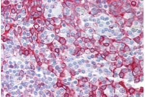 Anti-OGFOD1 antibody IHC staining of human tonsil. (OGFOD1 抗体  (C-Term))