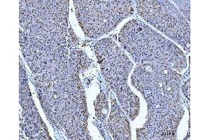 IHC analysis of ACLY using anti-ACLY antibody (ABIN4886416). (ACLY 抗体  (AA 1-180))