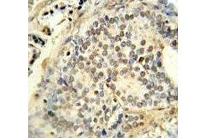 Immunohistochemistry (IHC) image for anti-Fused in Sarcoma (FUS) (AA 499-526) antibody (ABIN3031006)