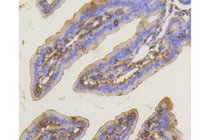 Immunohistochemistry of paraffin-embedded mouse intestin using PRKCA antibody (ABIN5997085) at dilution of 1/100 (40x lens). (PKC alpha 抗体)