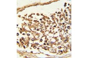 Formalin-fixed and paraffin-embedded human Testis tissue reacted with JMJD2B Antibody (N-term) followed which was peroxidase-conjugated to the secondary antibody, followed by DAB staining. (KDM4B 抗体  (N-Term))