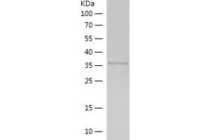 Western Blotting (WB) image for RB1-Inducible Coiled-Coil 1 (RB1CC1) (AA 1480-1594) protein (His-IF2DI Tag) (ABIN7124795) (FIP200 Protein (AA 1480-1594) (His-IF2DI Tag))