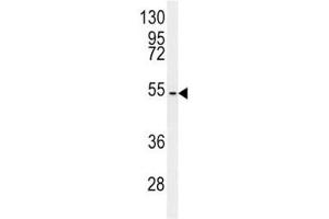 Western Blotting (WB) image for anti-CCZ1 Vacuolar Protein Trafficking and Biogenesis Associated Homolog (S. Cerevisiae) (CCZ1) (AA 239-265) antibody (ABIN3028541)