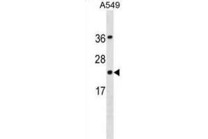 Western Blotting (WB) image for anti-Programmed Cell Death 6 (PDCD6) antibody (ABIN3001218) (PDCD6 抗体)