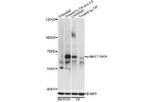 Western blot analysis of extracts of SH-SY5Y and C6 cells, using Phospho-MAPT-S404 antibody (ABIN2987503) at 1/2000 dilution. (MAPT 抗体  (pSer404))